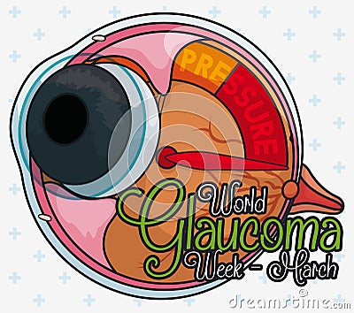 Sick Eye like Manometer with High Pressure Commemorating Glaucoma Week, Vector Illustration Vector Illustration