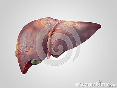 Sick human liver with cancer Cartoon Illustration