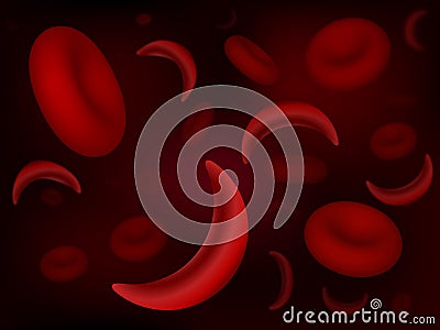 Sickle-cell and normal red blood cells Stock Photo