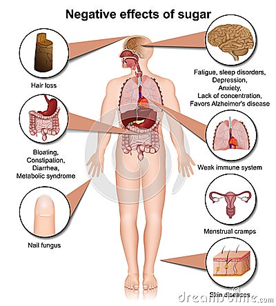 Side effects of sugar on the human body 3d medical illustration Cartoon Illustration