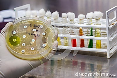 Side view of Culture plate of bacterial growth showing antibiotic sensitivity in their colony pattern placed geld in gloved hand Stock Photo