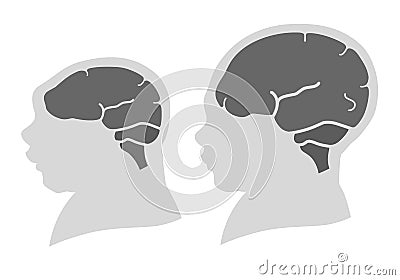 Silhouette image of the head and skull of a newborn child with a normal cranium and with microcephaly and severe microcephaly. Stock Photo