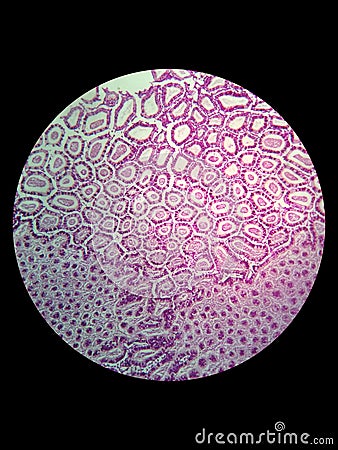Simple epithelial cell of kidney Stock Photo