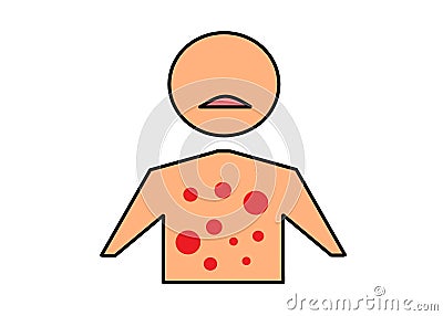 A simple shape of a human body upper torso with red dots indicating rashes and sensitive skin Cartoon Illustration