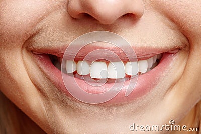 Sincere wide smile girls closeup. White teeth Stock Photo