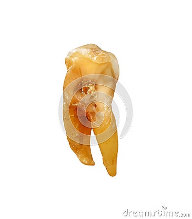 Single human tooth with caries isolated on white background , clipping path macro Stock Photo