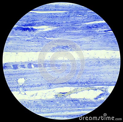 Skeletal muscle tissue longitudinal section under a microscope, Stock Photo