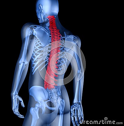 Skeleton of the man with the backache Stock Photo