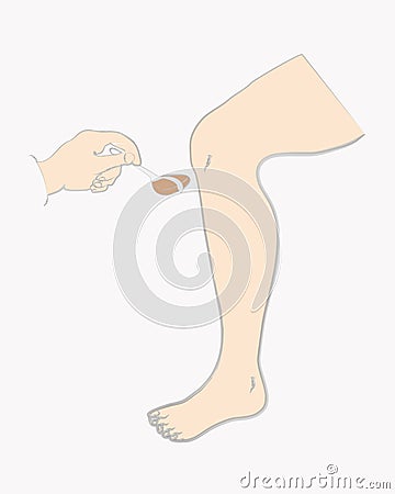 Sketch;cartoon knee reflex test Vector Illustration