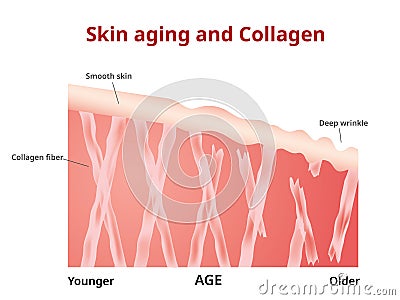 Skin aging, Collagen in young and old skin Vector Illustration