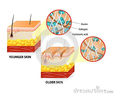 Skin aging Vector Illustration