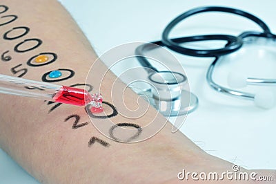 Skin allergy test Stock Photo