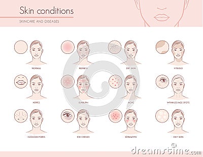 Skin conditions Vector Illustration