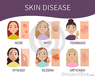 Skin disease Vector Illustration