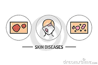 Skin diseases color line icons concept. Isolated vector element. Outline pictograms for web page, mobile app, promo Vector Illustration