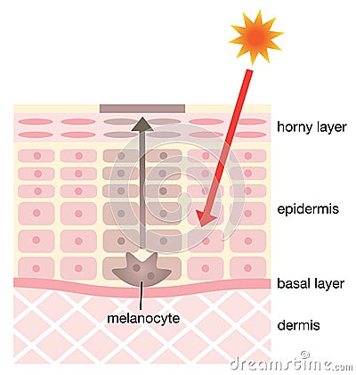 Skin mechanism of blotches Vector Illustration