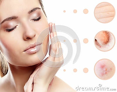 Skin problem of woman face Stock Photo