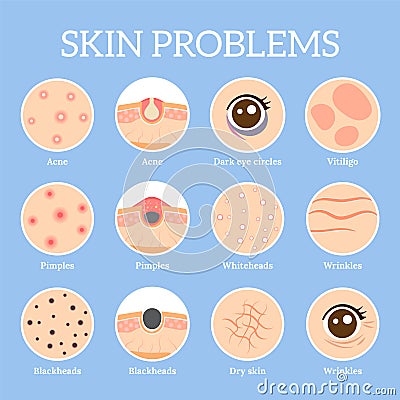 Skin problems. Ages wrinkles problem, face skin infection treatment and dark circles under eyes vector icons set Vector Illustration