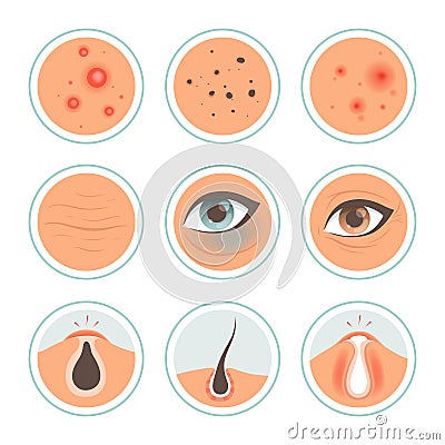 Skin problems. Dark circles woman infection spot washing skin oily face ages pore cleanse vector medical icon Vector Illustration