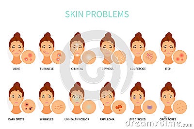 Skin problems vector Vector Illustration