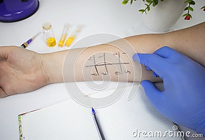 An allergist doctor in the laboratory conducts a prik allergy test. Skin test for household, food, epidermal allergic reactions Stock Photo
