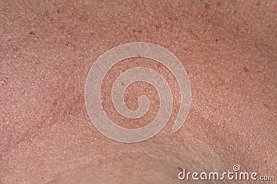 Skin texture Stock Photo
