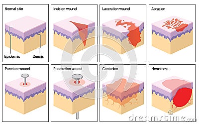 Skin wounds Cartoon Illustration