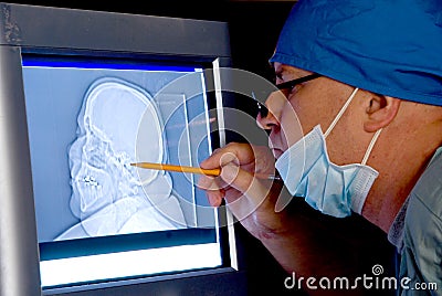 Skull Xray Stock Photo