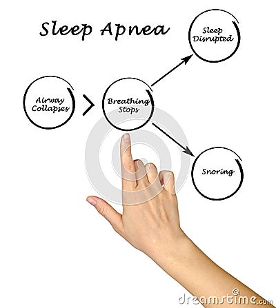 Sleep Apnea Stock Photo