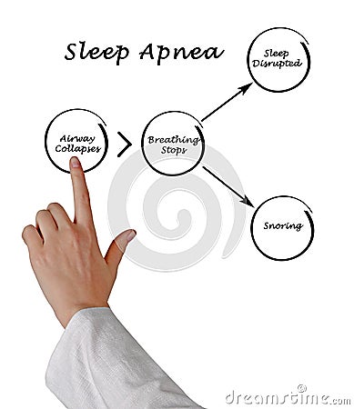 Sleep Apnea Stock Photo