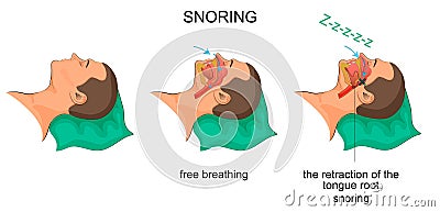 Sleeping man snores Vector Illustration