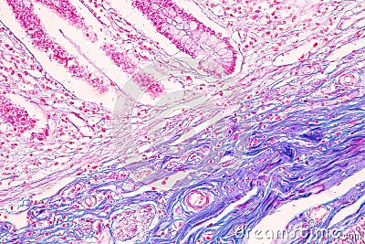 Small intestine Duodenum and Vermiform appendix Human under the microscope. Stock Photo