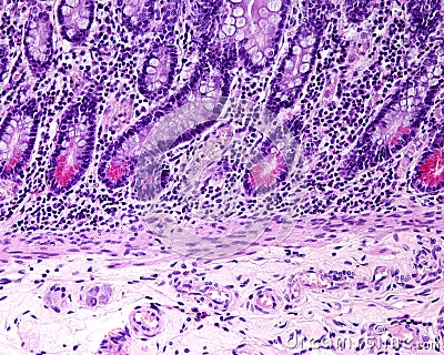 Small intestine. Paneth cells Stock Photo