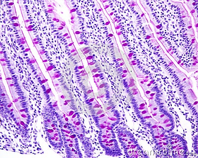 Small intestine. PAS technique Stock Photo