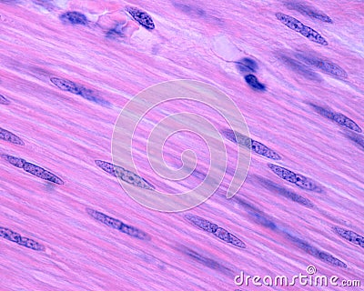 Small intestine. Smooth muscle fibers Stock Photo