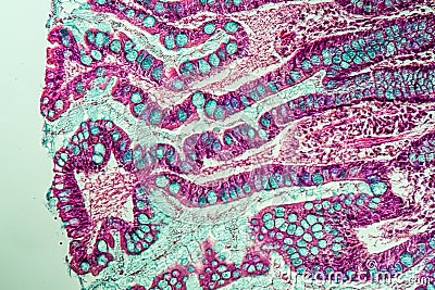 Small intestine with villi under the microscope Stock Photo