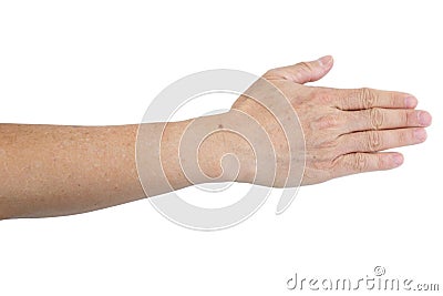 Small white and brown spots on the skin of senior man arm Stock Photo