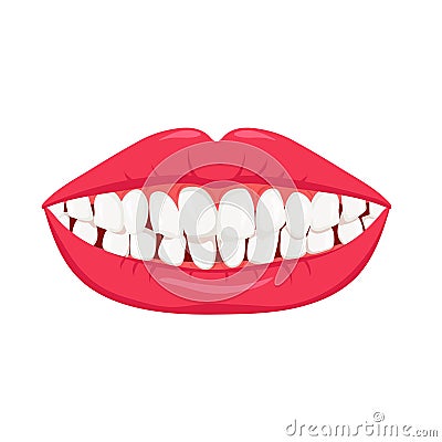 Smile with crooked teeth. White misaligned teeth with orthodontic bruxism Vector Illustration