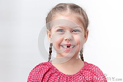 Smiling child without upper central teeth on white background Stock Photo