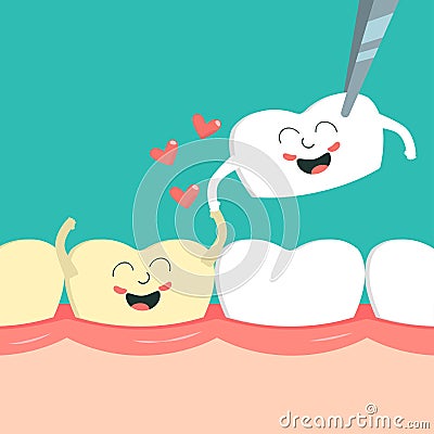 Smiling discolored tooth on gum and new veneer in love. Dental restoration Vector Illustration