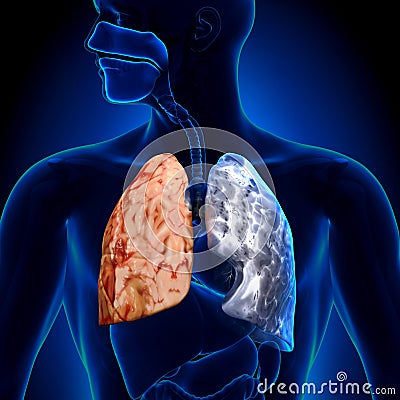 Smoker vs Non-smoker - Lungs Anatomy Stock Photo