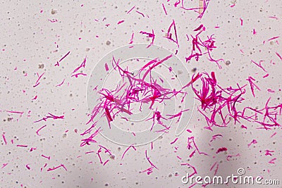 Smooth muscle separate under the microscope - Abstract pink line Stock Photo