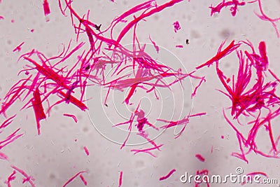 Smooth muscle separate under the microscope - Abstract pink line Stock Photo