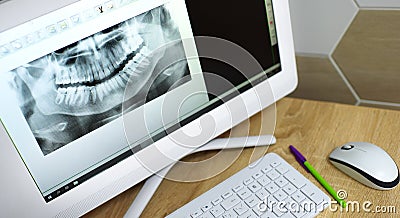 Snapshot of a tooth on a computer monitor. x-ray of teeth Stock Photo