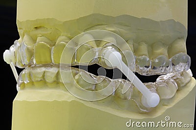 Snore splint Stock Photo