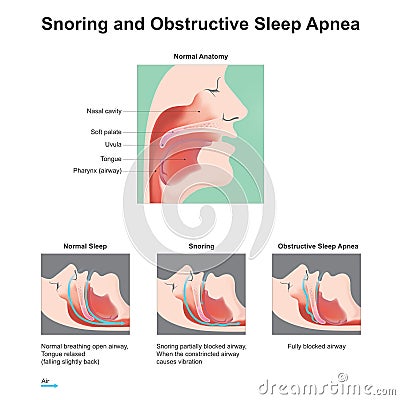 Snoring sleep. Stock Photo