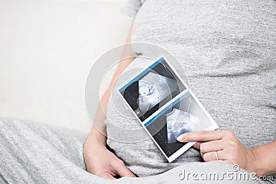 Soft focus and blurry of happy pregnant woman sitting on sofa at Stock Photo