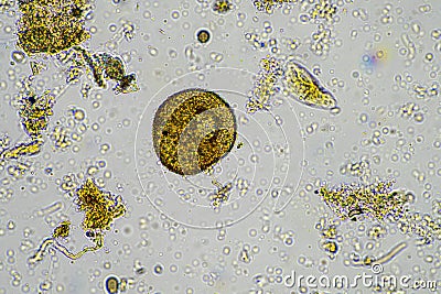 soil sample containing soil biology, with bacteria, fungi, amoeba, flagellate, and arcella, on a sustainable agricultural farm Stock Photo