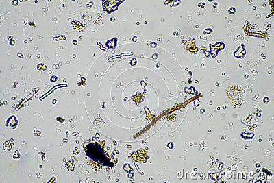 soil sample under the microscope. soil fungi and microorganisms cycling nutrients in compost Stock Photo