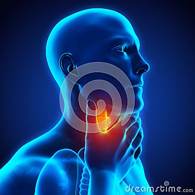 Sore Throat Illustration Stock Photo
